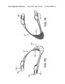 ADJUSTABLE CERVICAL COLLAR diagram and image