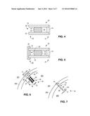 OPHTHALMIC SHUNT AND METHOD diagram and image