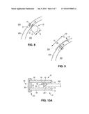 OPHTHALMIC SHUNT AND METHOD diagram and image