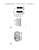 Methods and Treatments for the Learning and Memory Deficits Associated     with Noonan Syndrome diagram and image
