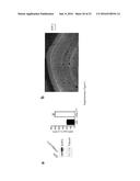 Methods and Treatments for the Learning and Memory Deficits Associated     with Noonan Syndrome diagram and image