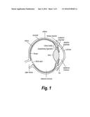 METHOD OF REDUCING INTRAOCULAR PRESSURE IN HUMANS diagram and image