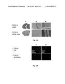 NDP-MSH FOR TREATMENT OF INFLAMMATORY AND/OR NEURODEGENERATIVE DISORDERS     OF THE CENTRAL NERVOUS SYSTEM diagram and image