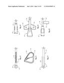 Indicia Informative of Characteristics of Insertable Medical Devices diagram and image