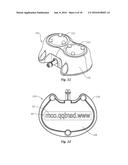 Indicia Informative of Characteristics of Insertable Medical Devices diagram and image