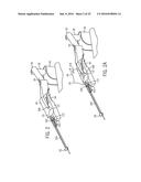 ROBOTIC CATHETER SYSTEM diagram and image