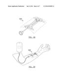 Integrated Vascular Delivery System diagram and image