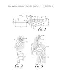 ANCHOR DEVICE FOR USE WITH CATHETERS diagram and image