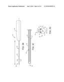 EXTRAVASCULAR IMPLANT TOOLS AND IMPLANT TECHNIQUES UTILIZING SUCH TOOLS diagram and image