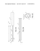 EXTRAVASCULAR IMPLANT TOOLS AND IMPLANT TECHNIQUES UTILIZING SUCH TOOLS diagram and image