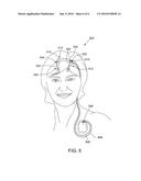 IMPLANTABLE NEUROSTIMULATION SYSTEMS AND METHODS THEREOF diagram and image