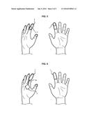 DEVICE FOR TREATING A CUTANEOUS ULCER diagram and image