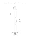 TEMPORARY ELECTRODE CONNECTION FOR WIRELESS PACING SYSTEMS diagram and image