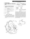 SYSTEMS AND METHODS FOR FIXATING TRANSVENOUSLY IMPLANTED MEDICAL DEVICES diagram and image