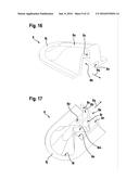 DRAINAGE END CAP DEVICE FOR DRAINING FLUID FROM A HOLLOW SPACE IN A     VEHICLE diagram and image