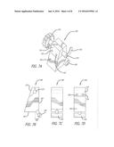 BICYCLE TRANSPORT CASE diagram and image