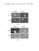 INHIBITORS OF THE FARNESOID X RECEPTOR AND USES IN MEDICINE diagram and image