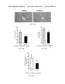 INHIBITORS OF THE FARNESOID X RECEPTOR AND USES IN MEDICINE diagram and image