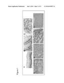 METHODS AND COMPOSITIONS FOR TREATING CANCER AND INFLAMMATORY DISEASES diagram and image