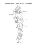 NOGO Receptor Antagonists diagram and image