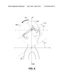 Use of Comparative Sensor Data to Determine Orientation of Head Relative     to Body diagram and image