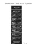 Multiview Light-Sheet Microscopy diagram and image