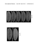 Multiview Light-Sheet Microscopy diagram and image