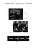 Multiview Light-Sheet Microscopy diagram and image