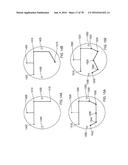 BACKFLUSH METHODS AND DEVICES FOR CHROMATOGRAPHY diagram and image