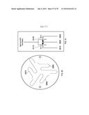 BACKFLUSH METHODS AND DEVICES FOR CHROMATOGRAPHY diagram and image