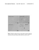 Method and Prognostic Kit for Monitoring Multiple Sclerosis (MS) diagram and image