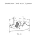 HYDROGEN PRODUCING FUEL CARTRIDGE AND METHODS FOR PRODUCING HYDROGEN diagram and image