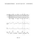 Amplifier Dynamic Bias Adjustment for Envelope Tracking diagram and image