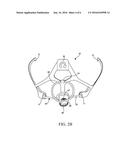 Cord Lock Fit System for a Helmet diagram and image