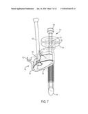 Cleaning Device for Cleaning a Scope, Laparoscope or Microscope Used in     Surgery or Other Medical Procedures and a Method of Using the Device     During Surgical or Other Medical Procedures diagram and image