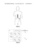 Method and Apparatus for Detecting Neural Injury diagram and image