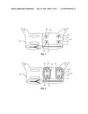 ATRIAL FIBRILLATION TREATMENT SYSTEMS AND METHODS diagram and image