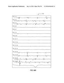 ATRIAL FIBRILLATION TREATMENT SYSTEMS AND METHODS diagram and image