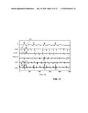 SYSTEM AND METHOD FOR TARGETING HEART RHYTHM DISORDERS USING SHAPED     ABLATION diagram and image