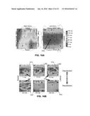 SYSTEM AND METHOD FOR TARGETING HEART RHYTHM DISORDERS USING SHAPED     ABLATION diagram and image