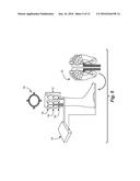 Sensory Prosthetic for Improved Balance Control diagram and image