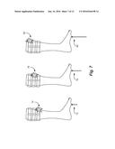 Sensory Prosthetic for Improved Balance Control diagram and image