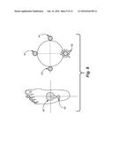 Sensory Prosthetic for Improved Balance Control diagram and image