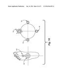 Sensory Prosthetic for Improved Balance Control diagram and image