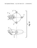 Sensory Prosthetic for Improved Balance Control diagram and image