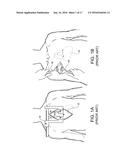 SURGICAL RIB RETRACTOR AND METHODS THEREOF diagram and image