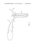 Methods and Devices for Threading Sutures diagram and image