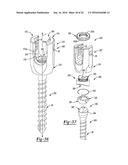 UNIPLANAR BONE ANCHOR SYSTEM diagram and image