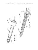 Bioactive Fusion Device diagram and image