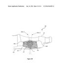 BONE PLATE WITH ELEVATED SUTURE HOLE STRUCTURES diagram and image